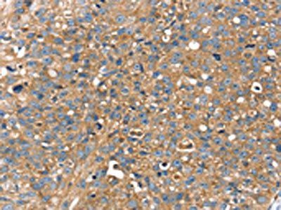 RAB9A Antibody