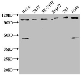 RABEP1 antibody