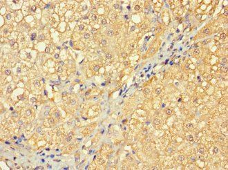 RABGAP1L Antibody