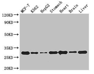 RABGAP1L Antibody