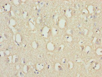 RABGEF1 Antibody