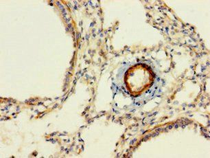 RABGGTA Antibody
