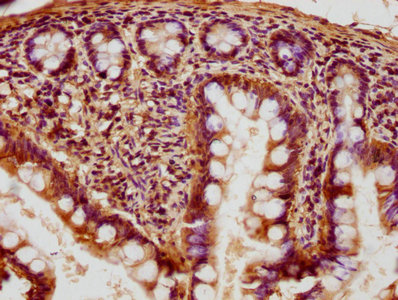 RABGGTB antibody