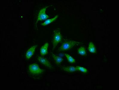 RAC-beta threonine-protein kinase antibody