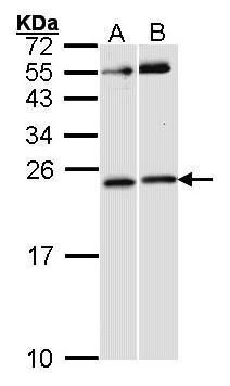 RAC1 antibody