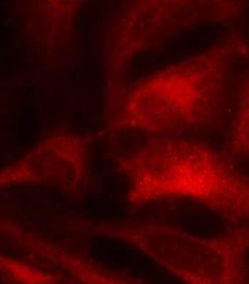 Rac1 (Ab-71) Antibody