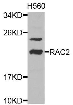 RAC2 antibody