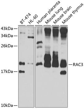 RAC3 antibody