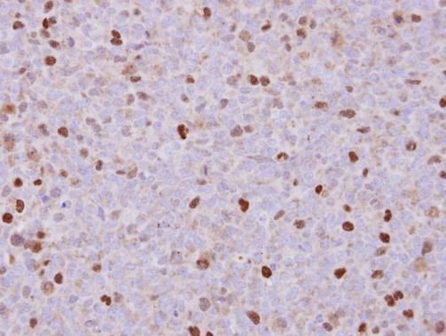 RACGAP1 antibody [N1N2], N-term