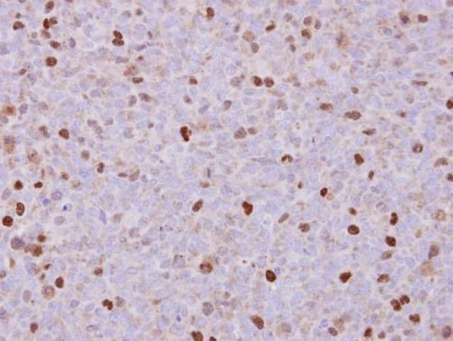 RACGAP1 antibody