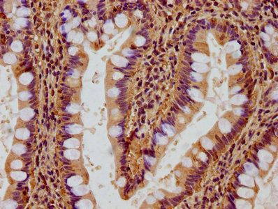 RACK1 Antibody