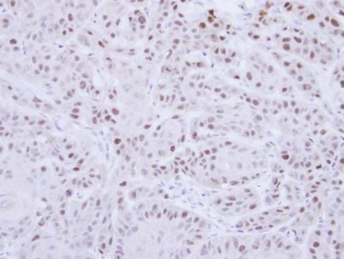 RAD18 E3 ubiquitin protein ligase Antibody