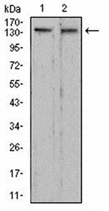 RAD50 Antibody