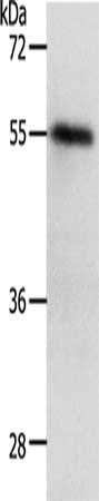 RAD52 antibody