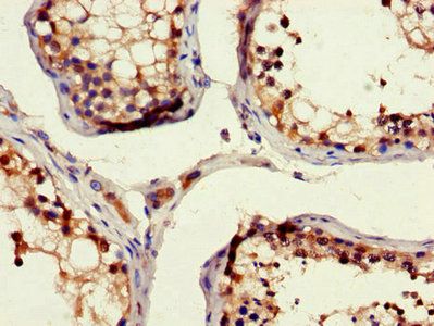 RAD54B Antibody