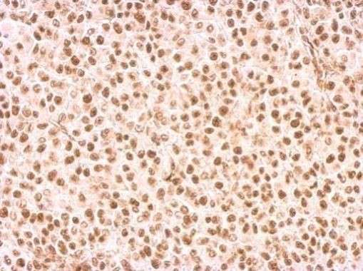 Rad9 antibody