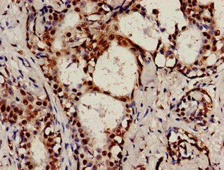 RAD9A Antibody
