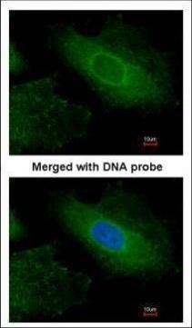 radixin Antibody