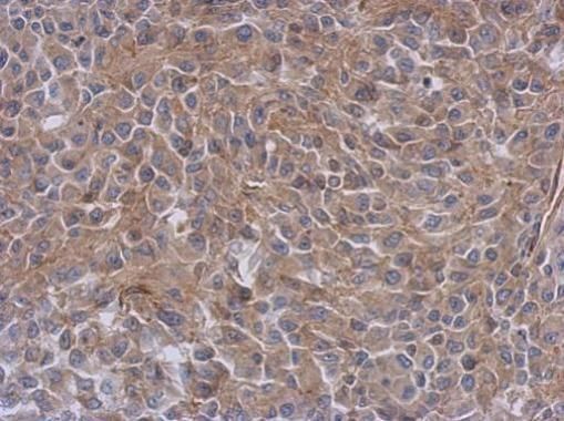 radixin Antibody