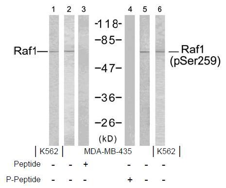 Raf1 (Phospho-Ser259) Antibody