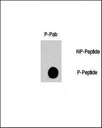 RAF1 (phospho-Ser338) antibody