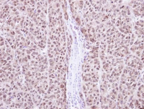 RAG2 antibody