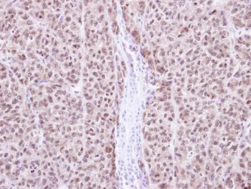 recombination activating 2 Antibody