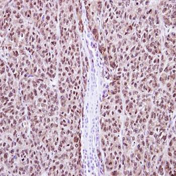 RAG2 antibody