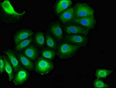 RAI1 antibody