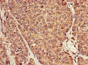 RAI1 Antibody