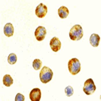 RAIDD Antibody