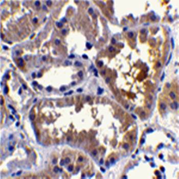 RAIDD Rabbit Polyclonal Antibody