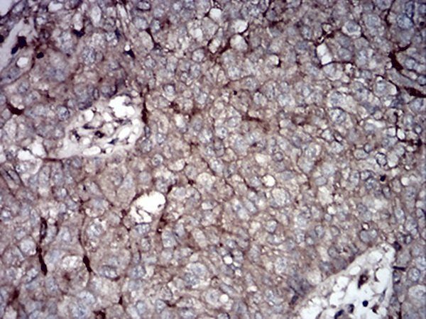 RALA Antibody