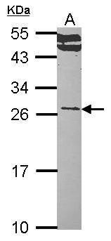 RAS like proto-oncogene A Antibody
