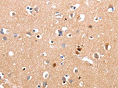 RALB Antibody