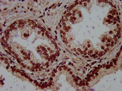 RALY Antibody