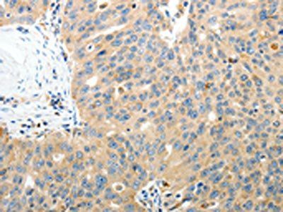RAMP3 Antibody
