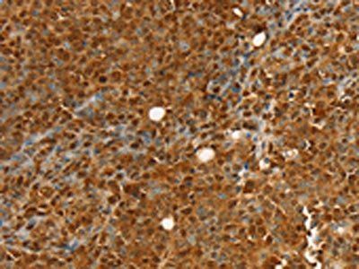 RAN Antibody