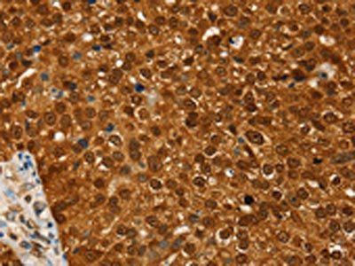 RAN Antibody
