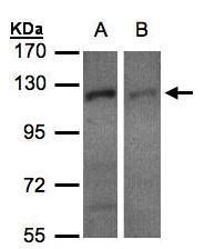 RanBP16 antibody