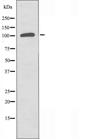 RANBP17 Antibody