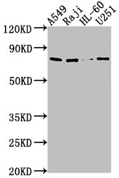 RANBP9 antibody