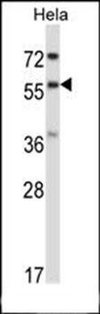 RANGAP1 antibody