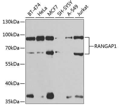 RANGAP1 antibody