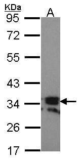 RANK Ligand antibody