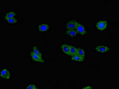 RANKL antibody