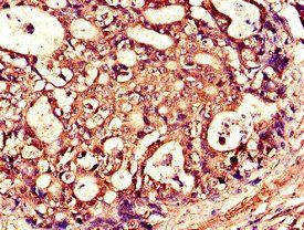 TNFSF11 Antibody