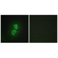 TNFSF11 Antibody
