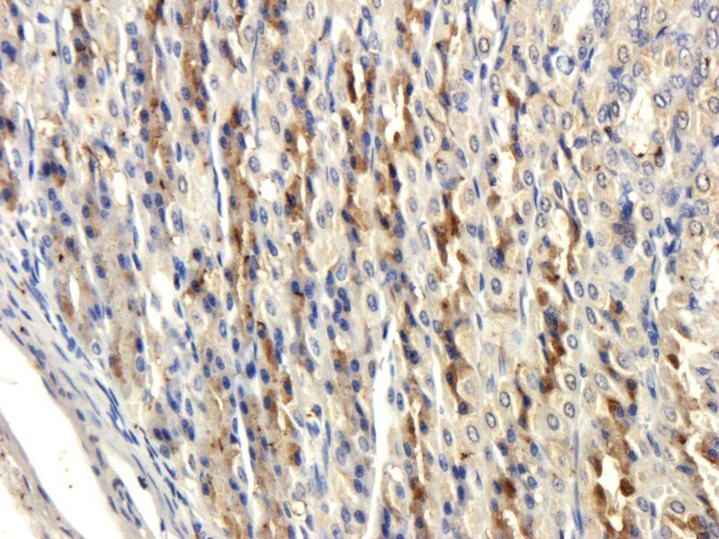 RANKL antibody