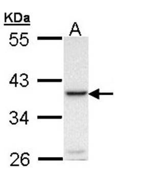 RANKL antibody